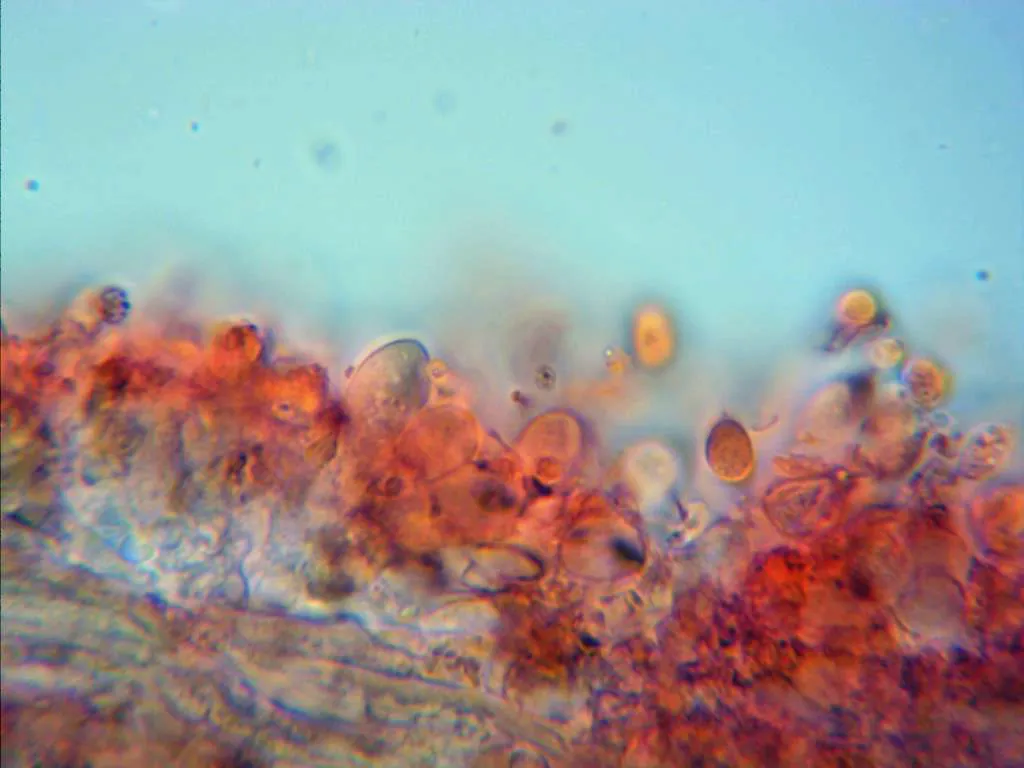 Microscopía de Marasmius splachnoides - 10 - Queilocistidios